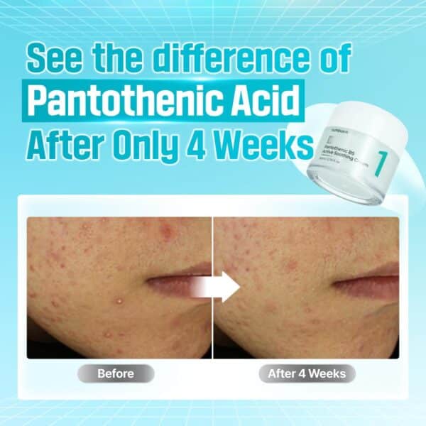 numbuzin No.1 Cream | Pantothenic B5 Active Soothing Cream | 80 ml - Image 3