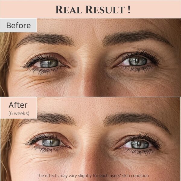 Beauty of Joseon Revive eye serum : Ginseng + Retinal, 30ml, 1fl.oz - Image 3